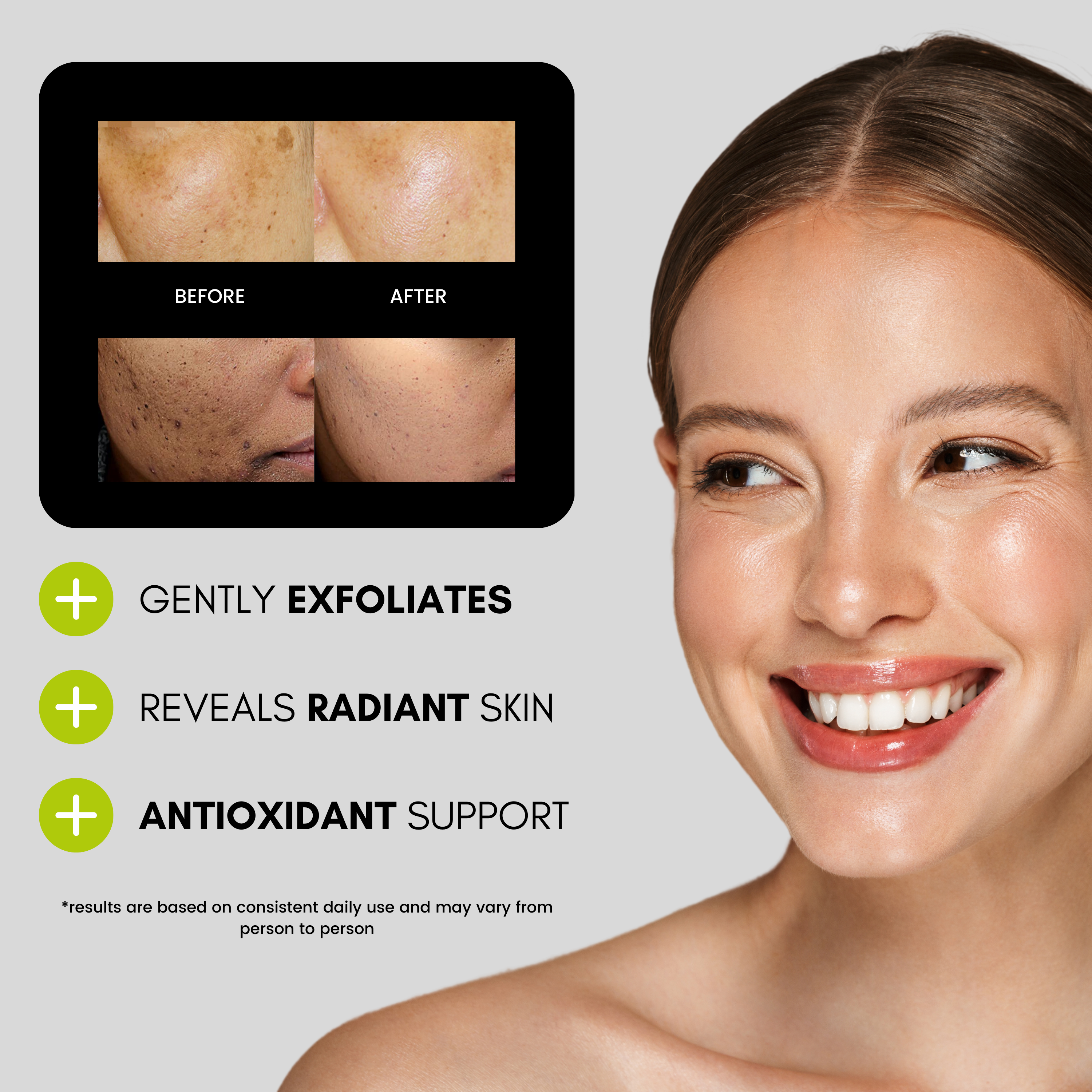 before and after kojic acid serum use with skinsetgo skincare. 